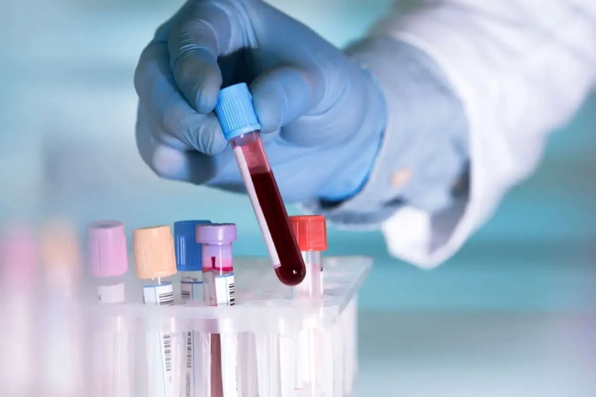 Kaip pasiruošti kraujo tyrimams, kad rezultatai būtų tikslūs?